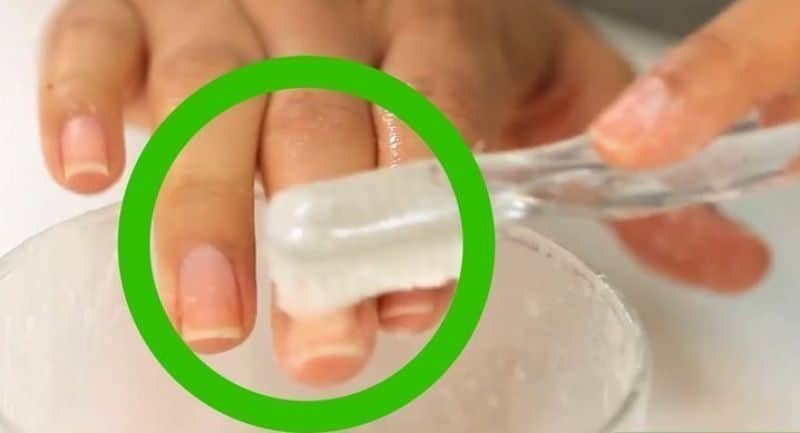 How to Whiten Yellow Nails in 10 Minutes ! - Glossypolish
